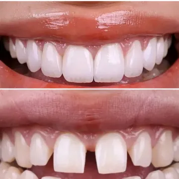 نمونه کار کامپوزیت