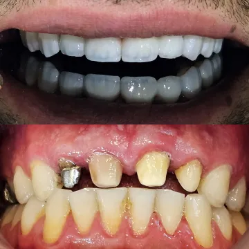 نمونه کار لمینت