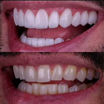 نمونه کار کامپوزیت